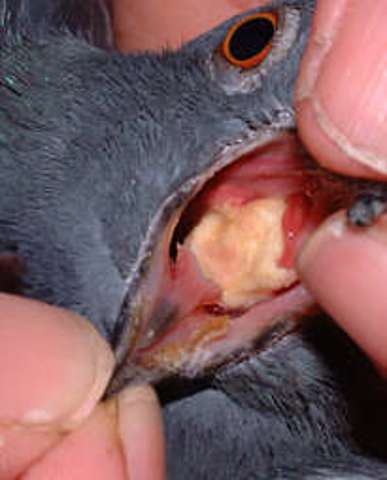 CANKER (Trichomoniasis)